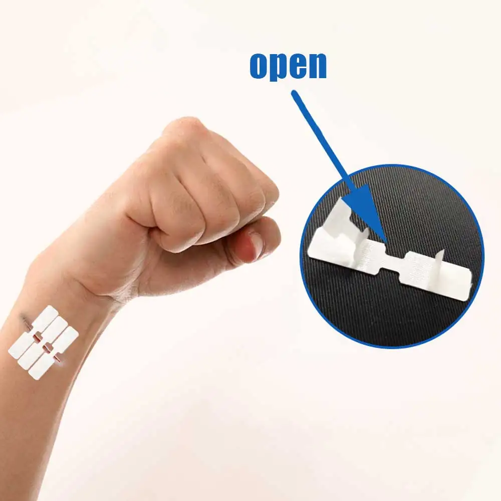 10 pces-100 pces ao ar livre ferida fita adesiva descartável primeiros socorros ferida sutura remendo ferida de emergência rápida sutura remendo