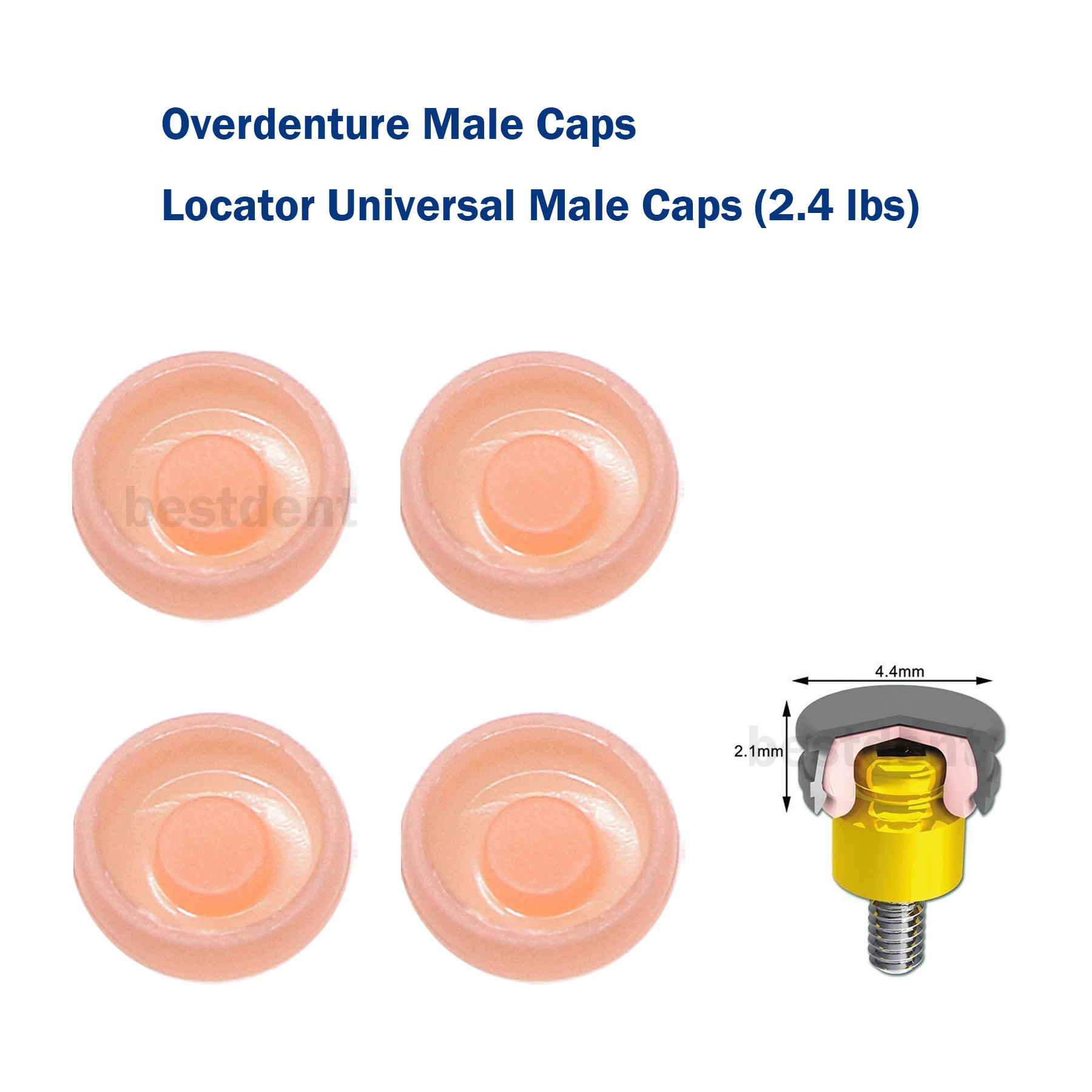 Dental Universal Overdenture Implant Retentive Caps 2.4lbs Pink Strong Removable Cap 4Pcs/Set