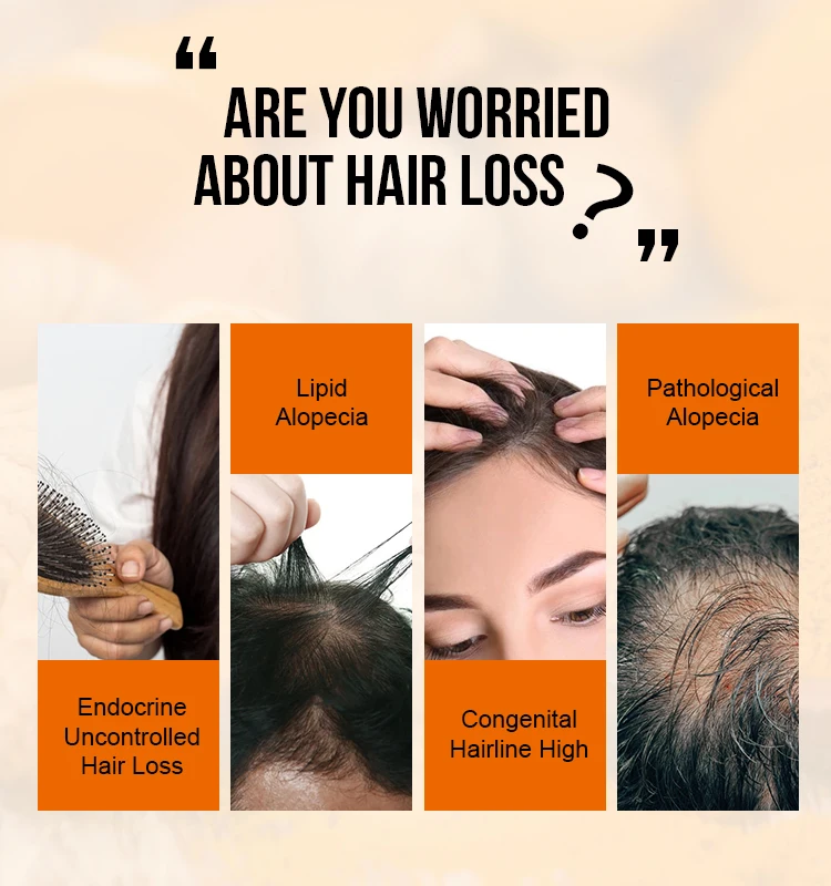 PURC Ingwer-Haarwachstumsöl, schnelle Haarausfall-Behandlung, glättende Reparatur, Produkte für geschädigtes Haarwachstum für Männer und Frauen, Haarpflege – Detail 4