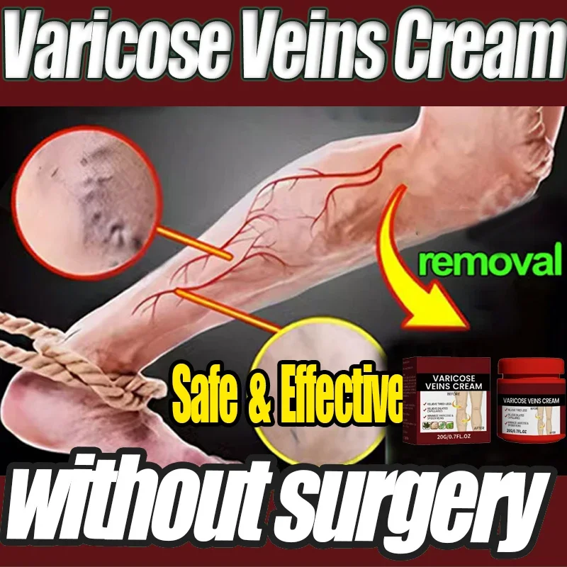 

Varicose Veins Effective Varicose Vein Relief To Relieve Vasculitis Phlebitis Spider Pain Treatment Foot Care2024