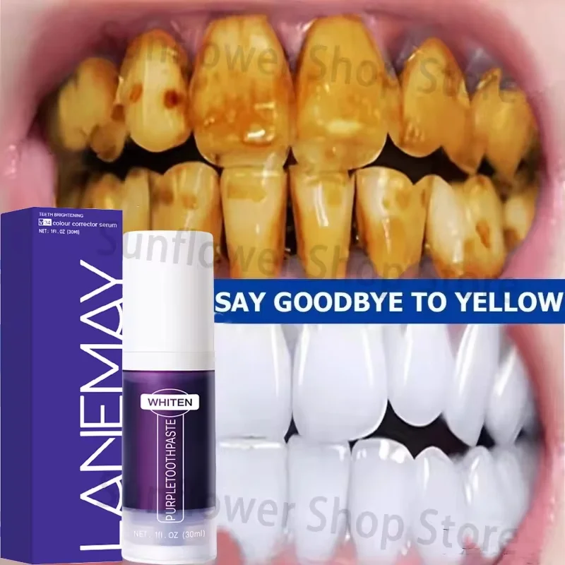 V34 Teeth Whitening Toothpaste Remove Plaque Coffee Stains Cleaning Oral Hygiene Bleaching Dental Tools Fresh Breath Tooth Care