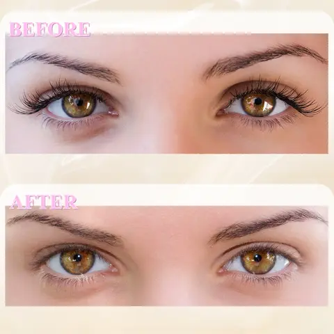 10 best sales fransborttagare - №5