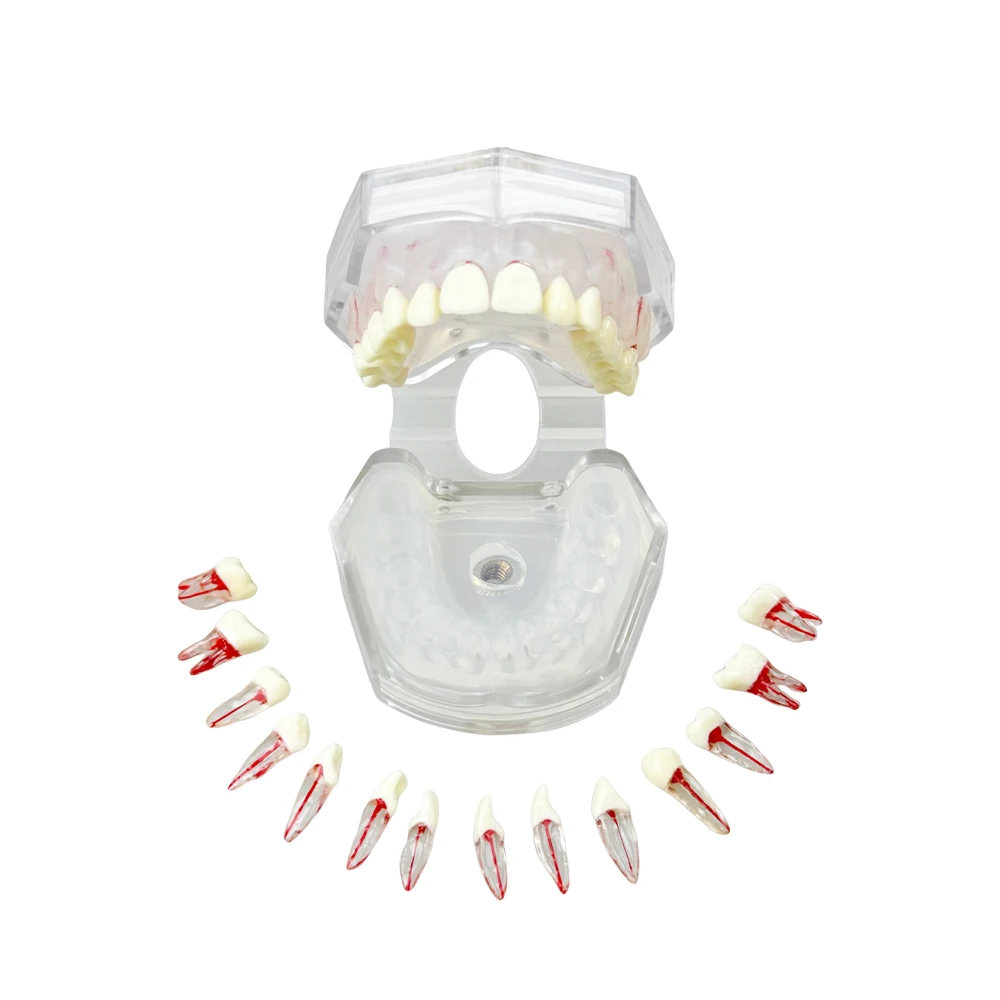 

Endodontic Teeth Model For Training Practice Tooth Extraction Model Dental Standard Model With Removable Root Canal Typodont New