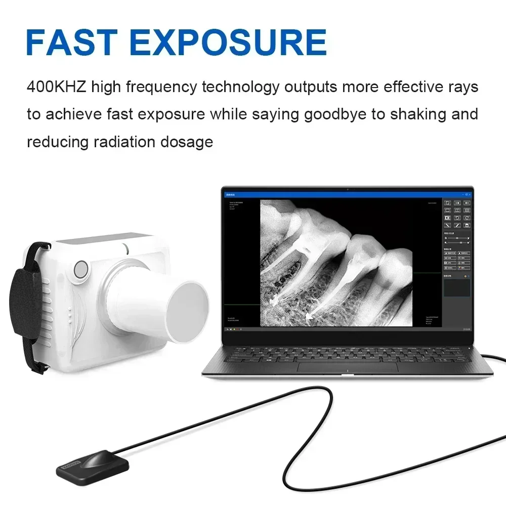 JINGT Dental Portable X-Ray Rayer Oral Sensor Suite In Digital Imaging System Handheld Filmmaker X-Ray Machine Intraoral Set