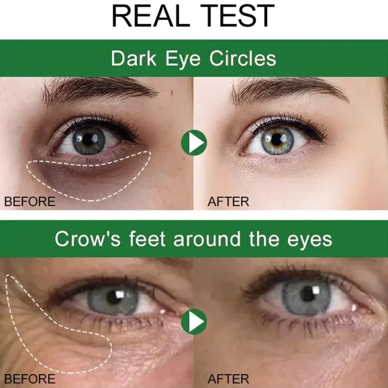 Crema de ojos para eliminar arrugas instantáneas, antiojeras, bolsas, hinchazón, desvanecimiento, línea fina, tensar, blanquear debajo de los ojos, cuidado de la piel, 7 días