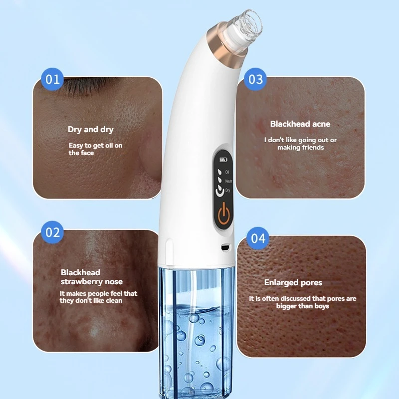 小さな泡の黒ずみ分析装置、毛穴の洗浄とニキビの除去、クレンジング、酸素注入、水分補給、肌の栄養補給
