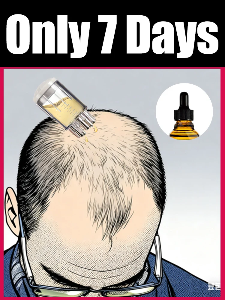 Applicateur de cuir chevelu 30ml, Essence, liquide de croissance des cheveux, boule de Massage, tête, livraison de médicaments, peigne de guidage liquide pour frottis