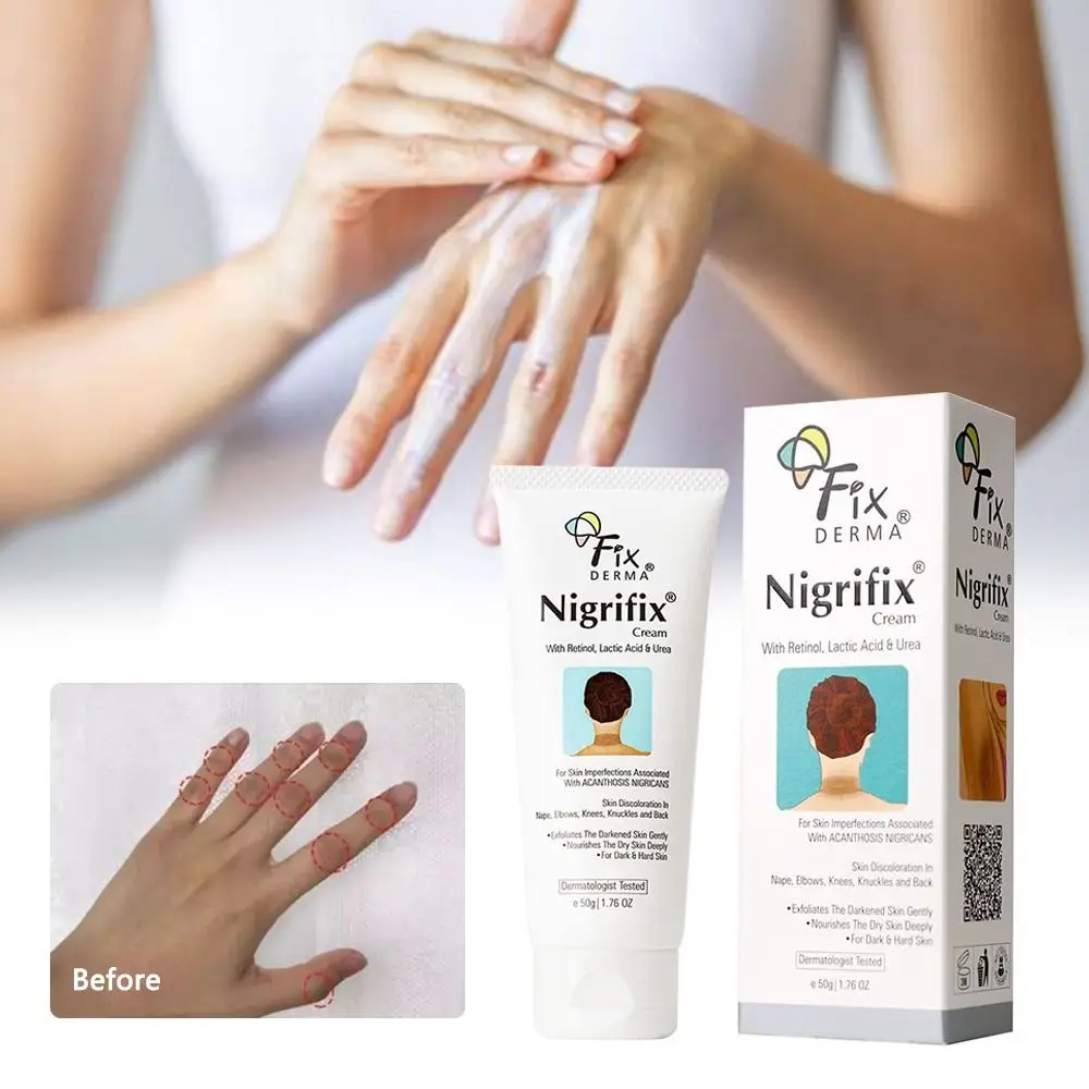 

Whitening Serum Acanthosis Nigricans Therapy Cream Nigricans Therapy Cream Fixderma Nigrifix Cream Dark Spot Corrector Cream