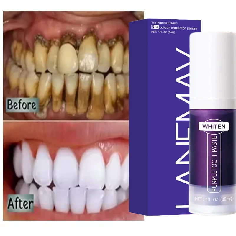 V34 Teeth Whitening Toothpaste Remove Plaque Coffee Stains Cleaning Oral Hygiene Bleaching Dental Tools Fresh Breath Tooth Care