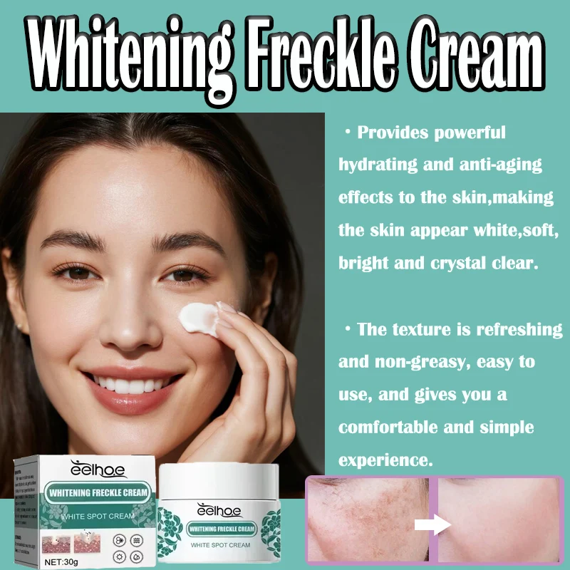EELHOE نيكوتيناميد النمش كريم مزيل الكلف كريم إزالة التصبغ ترطيب مصل إزالة البقع الداكنة