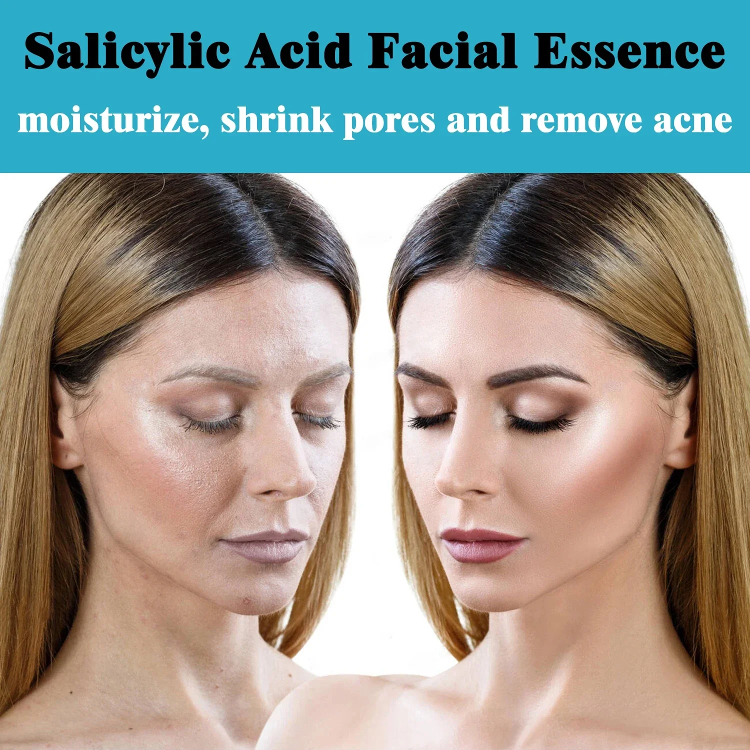 Salicylic Acid Exfoliating Serum Anti Aging Essential Oil Shrink Pores Remove Acne 30ml Face Peeling Gel Skincare