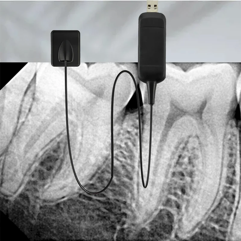 Three Size Dentistry Dental X-Ray Sensor High-Frequency Rx Digital Intraoral Digital System H D Image Radiovisografo Tools