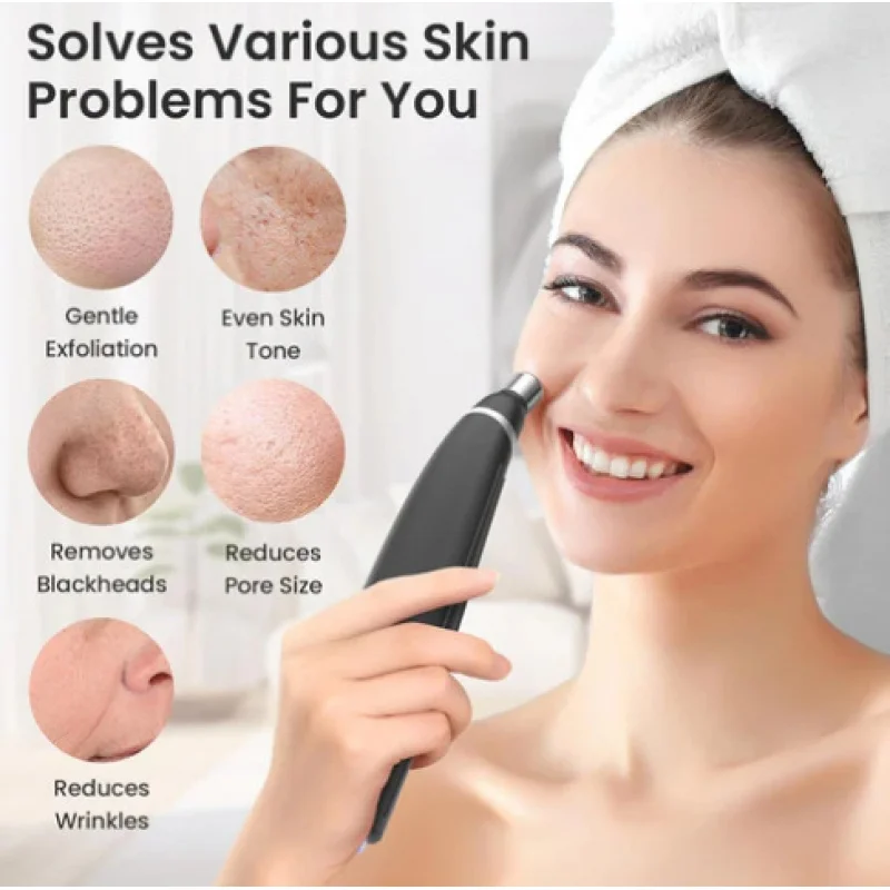 เครื่องผลัดเซลล์ผิวแบบพกพา ไมโครเดอร์มาเบรชั่น อุปกรณ์ทำความสะอาดผิวหน้า ขจัดเซลล์ผิวที่ตายแล้ว ดูดสิวเสี้ยน