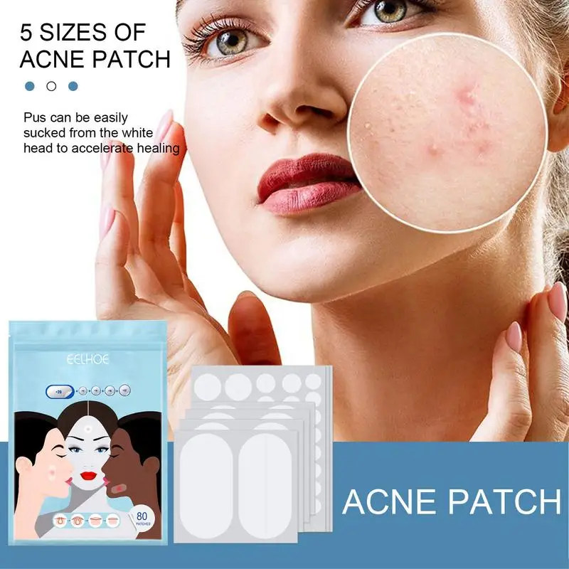 5 Maten 80 Stks/set Hydrocolloïde Verbanden Voor Acnes Puistje Huid Puistjes Breakouts Verwijdering Patches Verwijderaars Gezichtskin Lichaamsverzorging