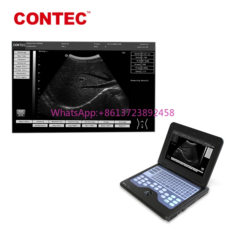

Contecmed laptop ultrasound human vet portable ultrasound machine