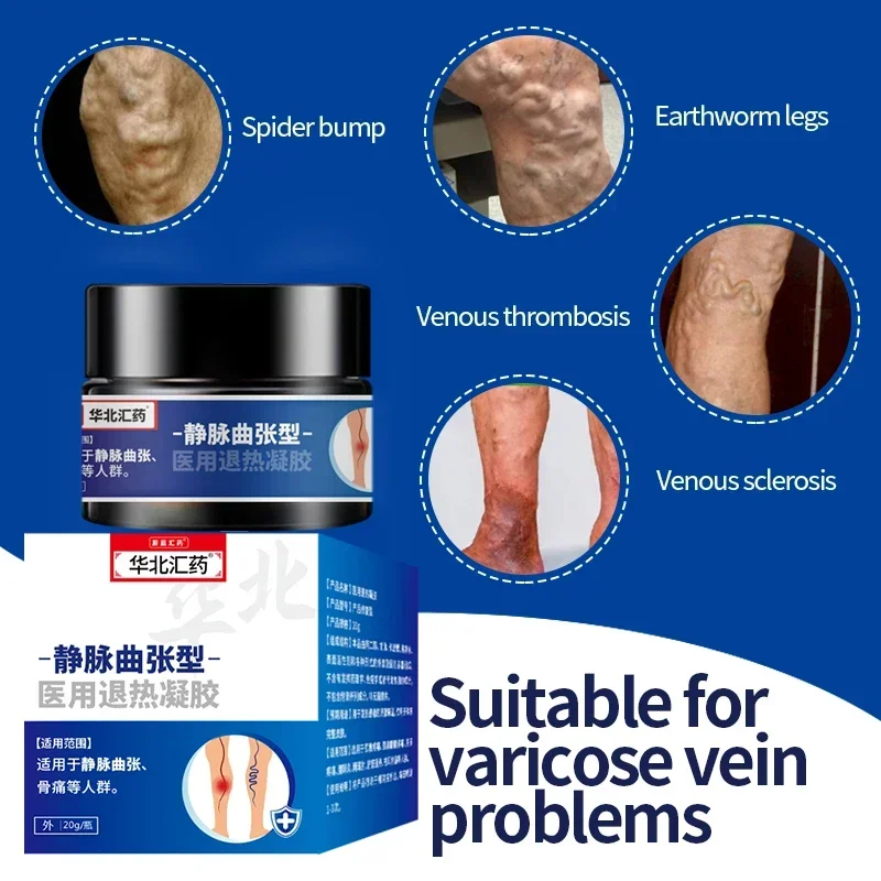 20g Varicose Veins Remover Herbal Cream Spider Legs Varicosity Angiitis Vascular Veins Treatment Chinese Medical Plaster