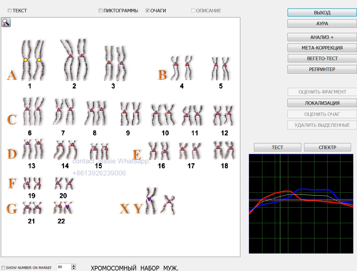 Russian software 12D NLS Bioresonance Aura Diagnose Nonlinear Analysis System Health Scanning Therapy Goods Analysis