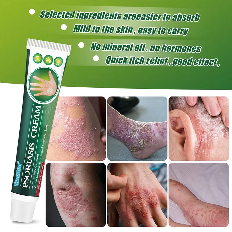 1Pcs 20g Sumifun Psoriasis Ointment Dermatitis Eczema Antibacterial Cream Tinea Versicolor Inhibit Fungus Anti-itching Plaster