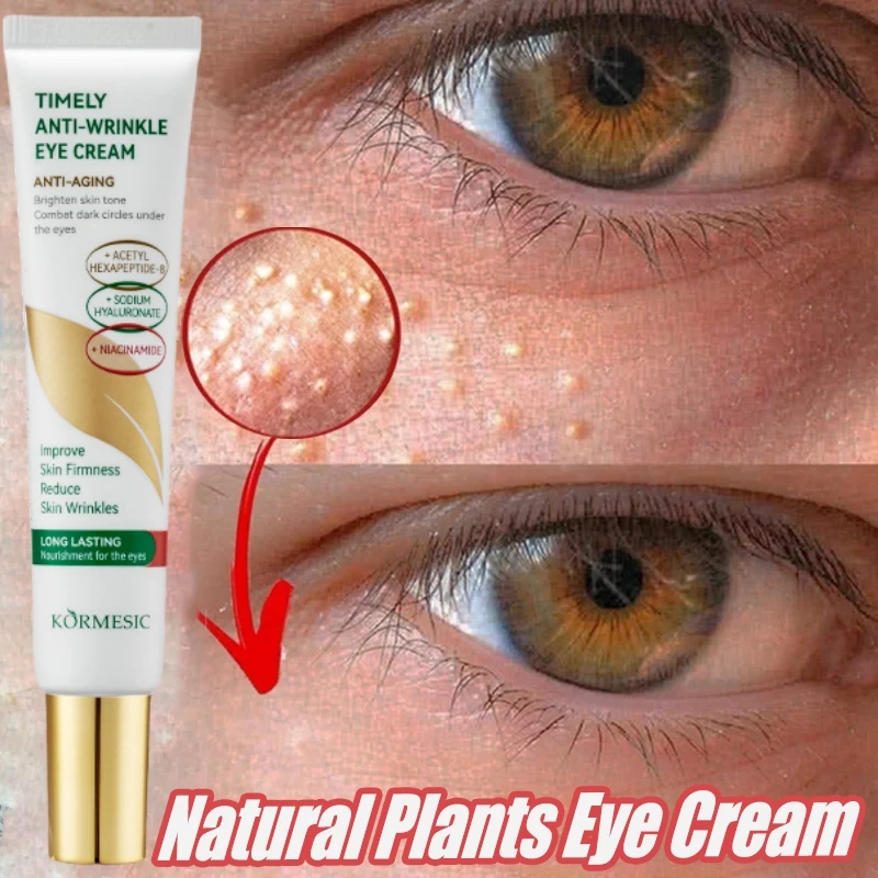 Anti Dark Circle Eye Cream Fat Granules Removal Cream Anti-Wrinkle Lifting Moisturizing Firming Anti-Puffiness Korean Skin Care