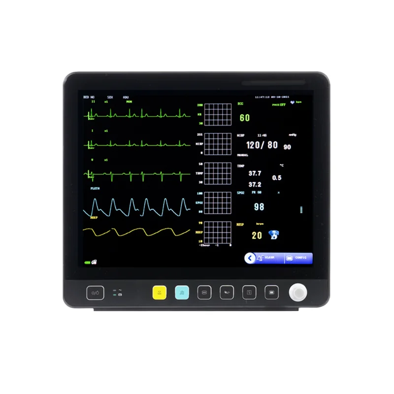 VE15 High Quality Cheap Price Pet Portable Veterinary Multiparameter Vi tal Si gns Cardiac Monitor with 15 Inch Tft Lcd Screen