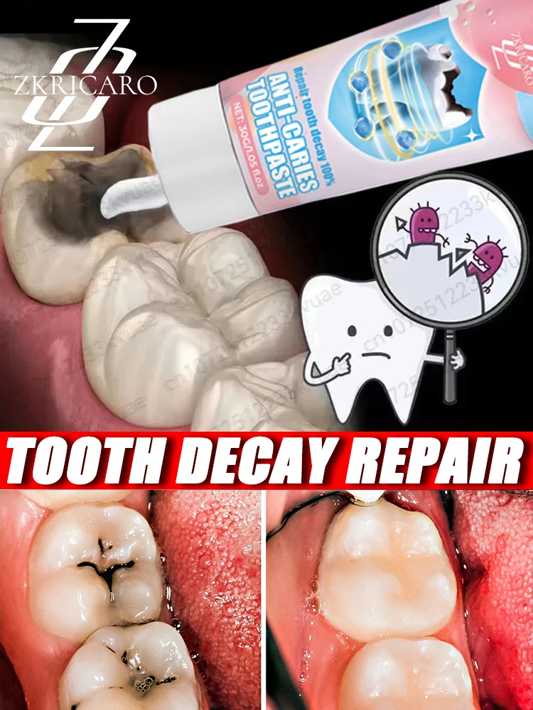 Anti-Cavity Toothpaste Tooth Remineralization Recovery Enamel Repair Strengthening Restoration Decay Protection Dental Teeth