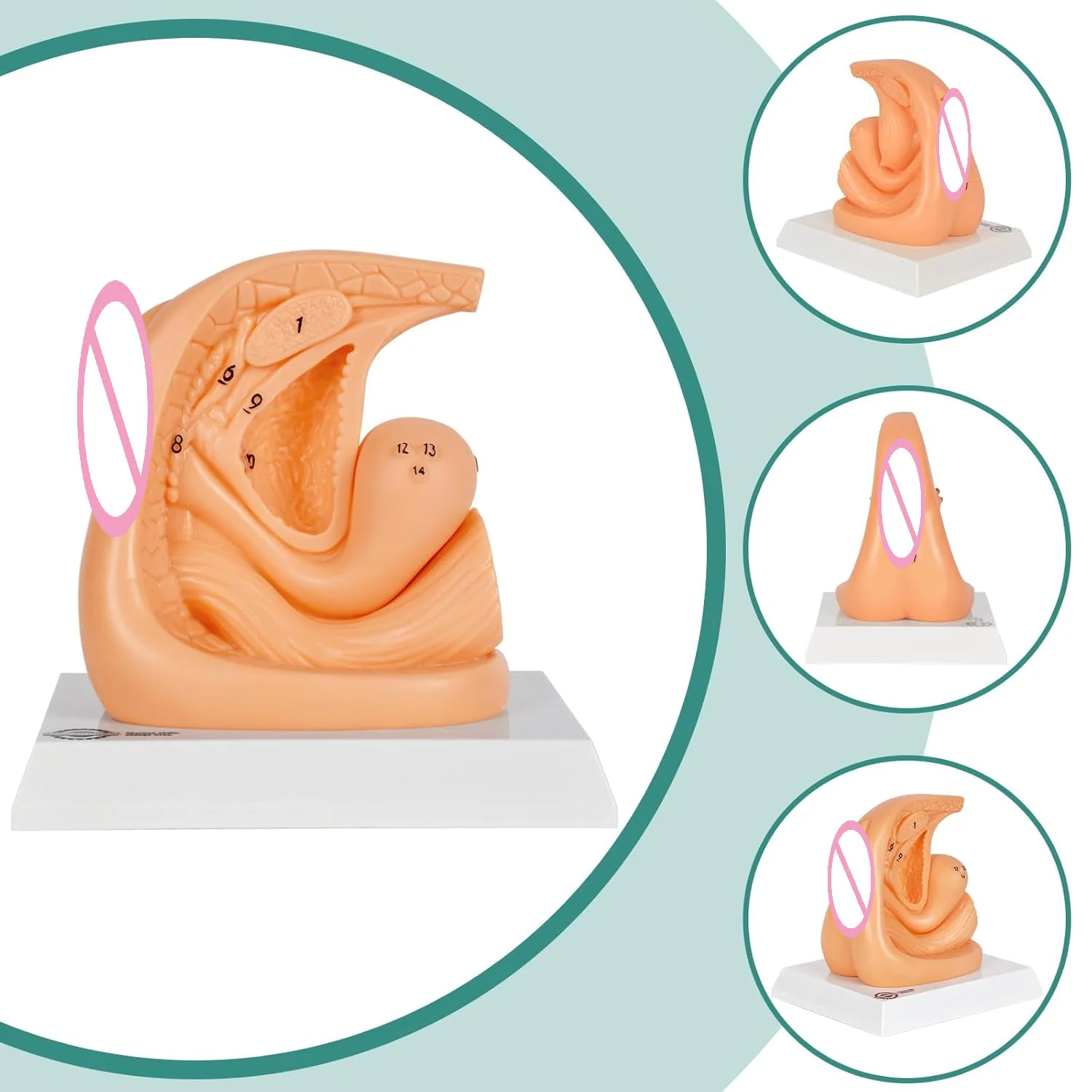 Ultrassist Genital Anatomy Model Urinary Catheterization Catheter Insertion Practice Trainers Male & Female for Medical Student