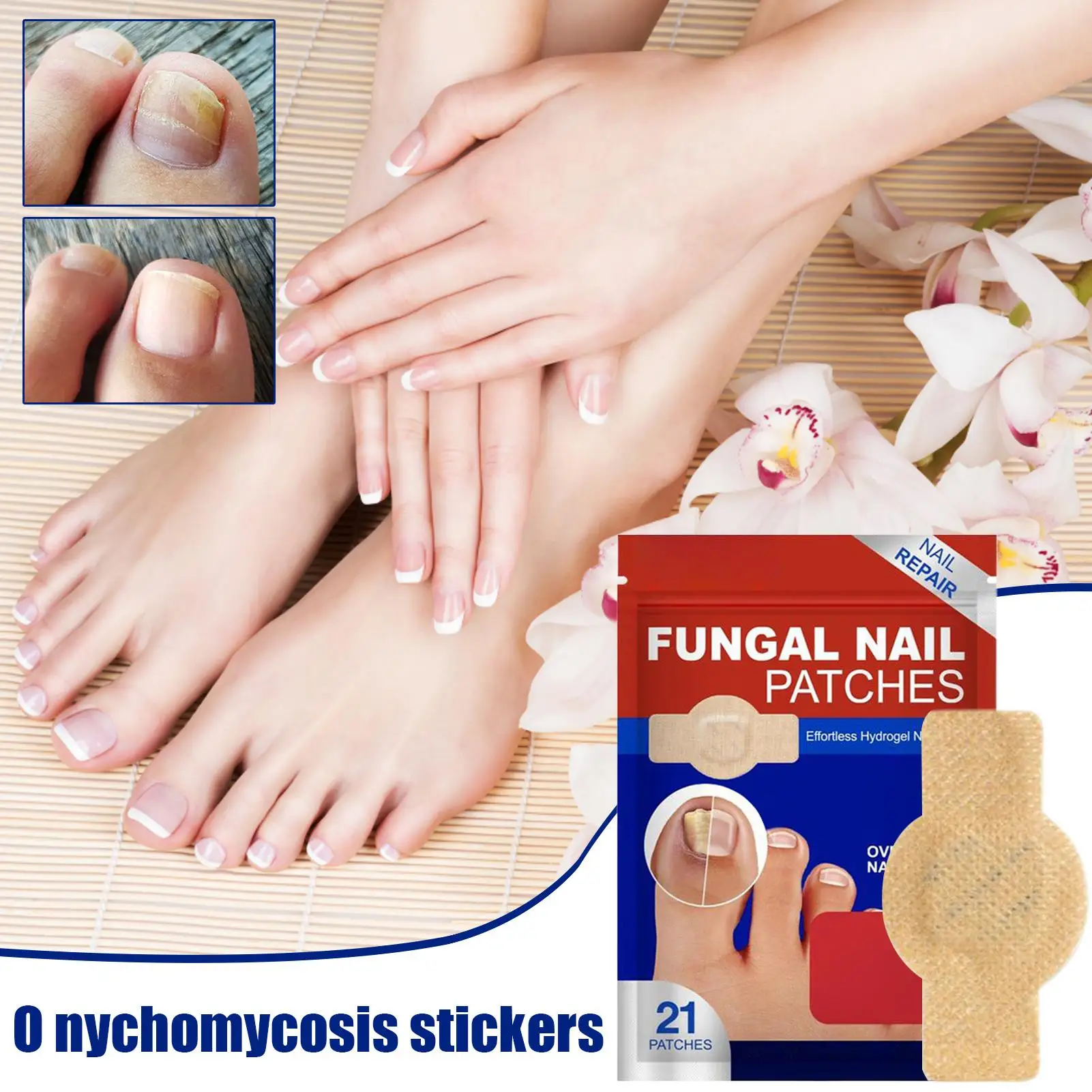 NailFungus Patch Wasserdichter Nagelreparaturpflaster Eingewachsene Korrekturaufkleber Beschädigter Nagel Graues Pflegepflaster Fußpflegewerkzeuge