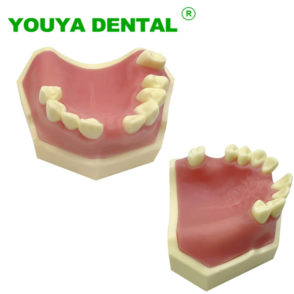 Dental Tooth Model Soft Gum Implant Practice Teeth Model Dentist Teaching Training Dentistry Typodont Model Demonstration Tools