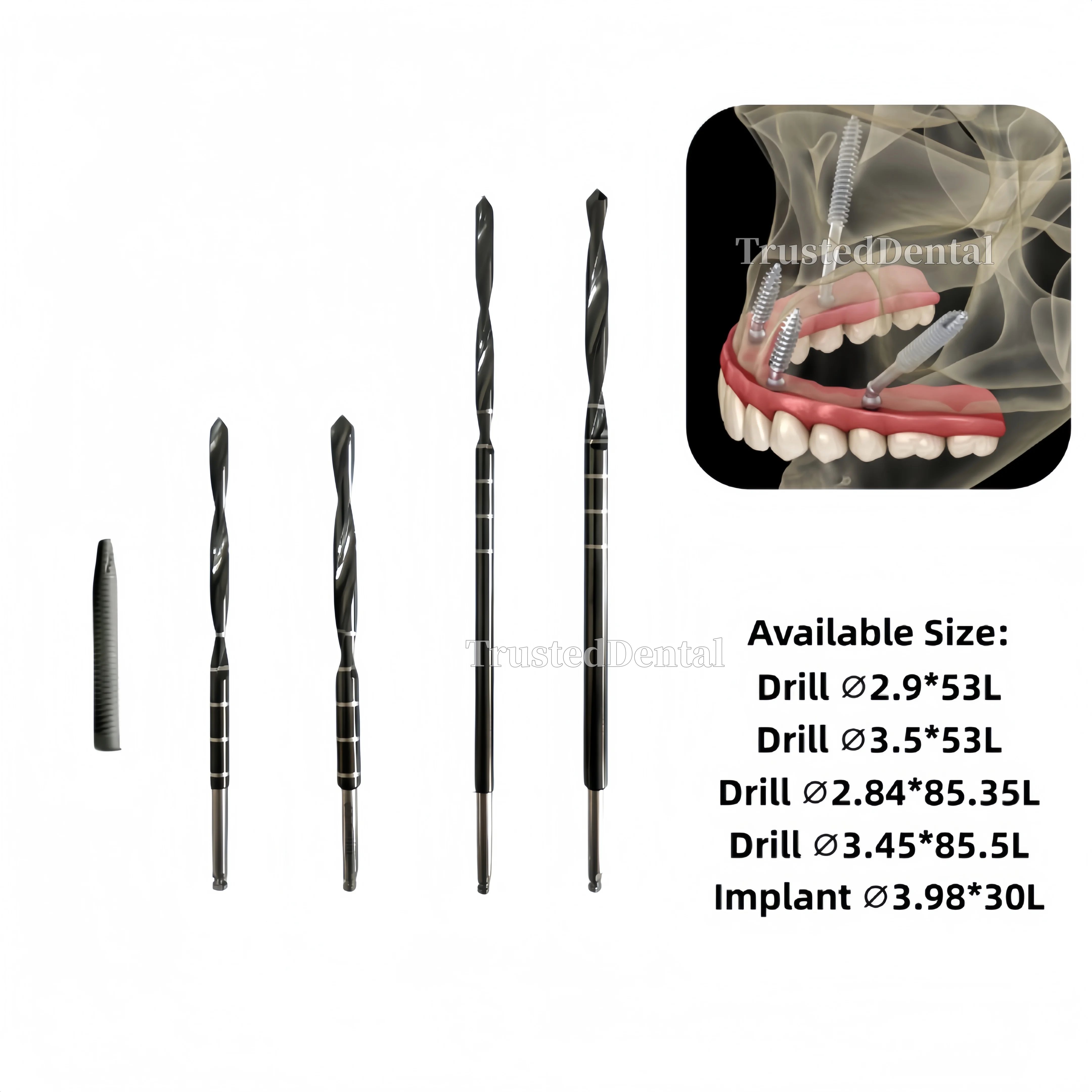 Dental Gdt Implants…