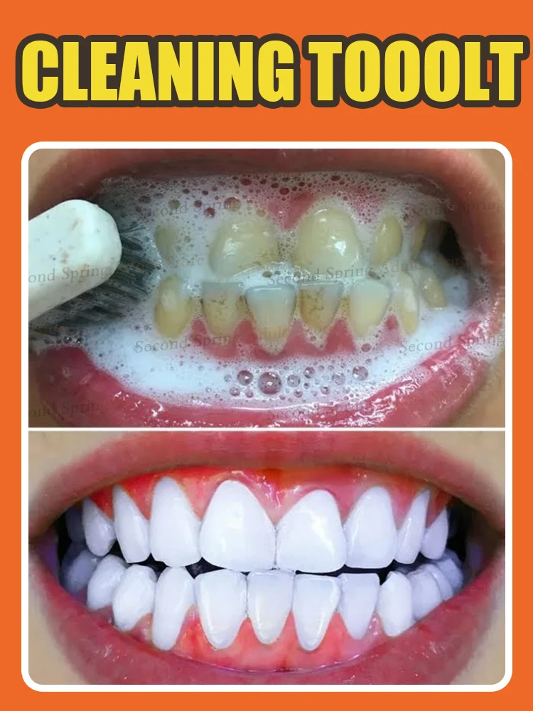 cleaning-kit-toolsremoves-stains-with-in-7-days2025-hot-selling-products