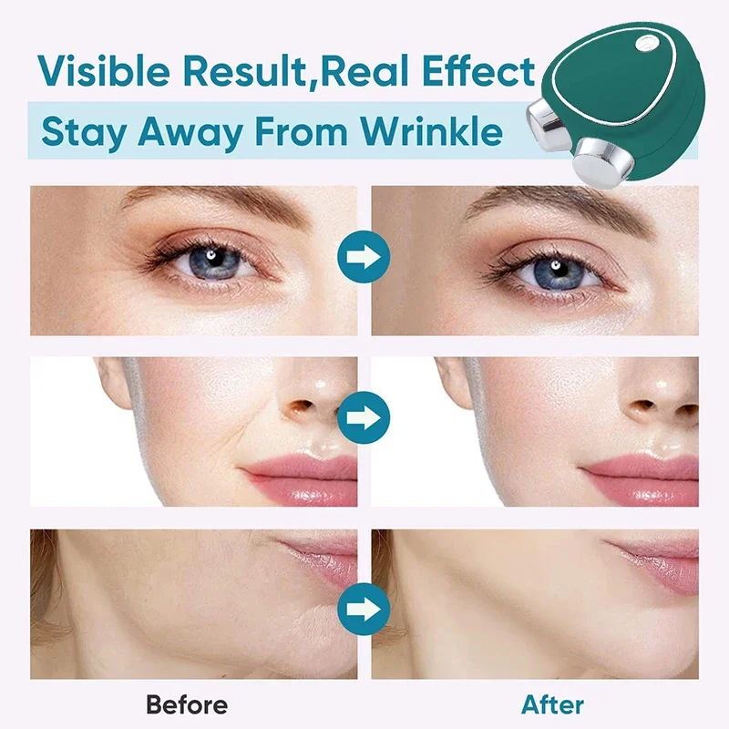 전기 얼굴 리프팅 롤러 ems 미세 전류 마사지 음파 진동 피부 강화 마사지 휴대용 미용 관리 장치