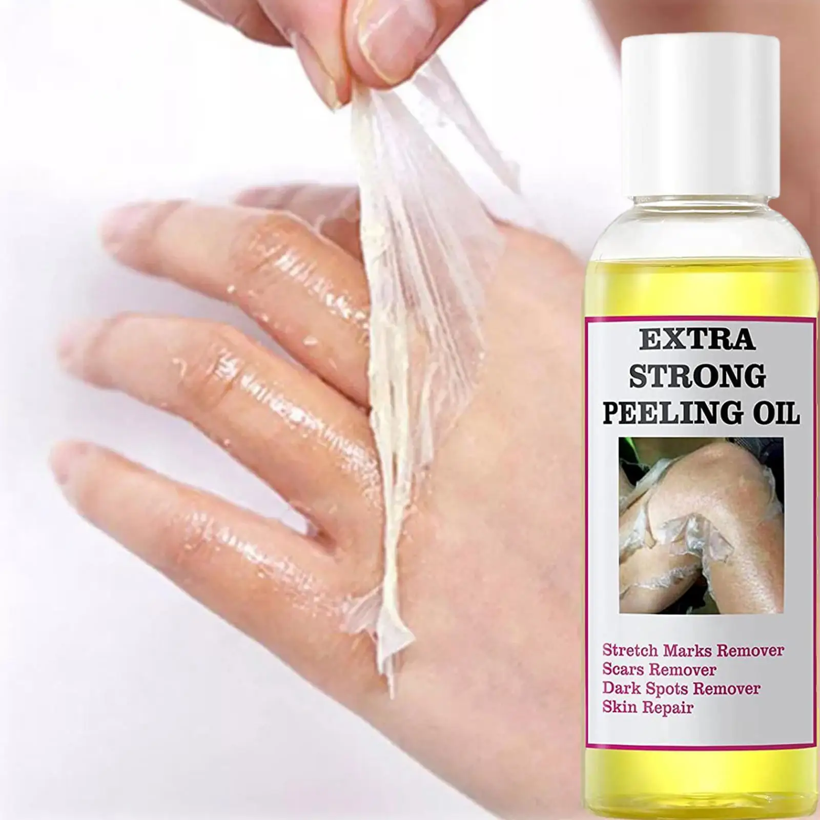 Yellow Peeling Oil Bleaching Dark Skin Spots Blackheads Skin Whitening Extra Treatment Oil Spot Blemishes Peeling Bad Stron Q1Q0