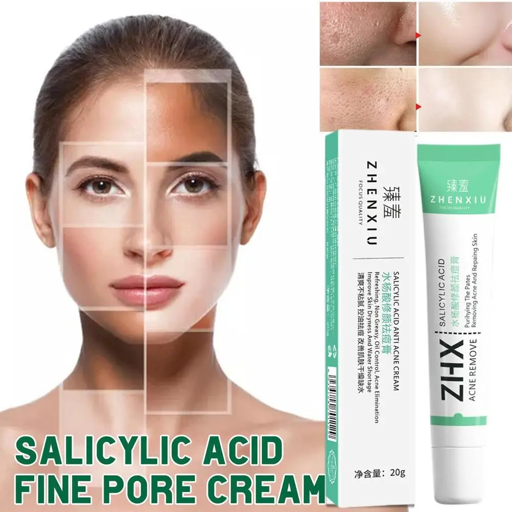Acne removendo creme com ácido salicílico, remoção de acne, clarear, regular a acne, pele, remover, marcas, poços, AC, D0b8, 20g