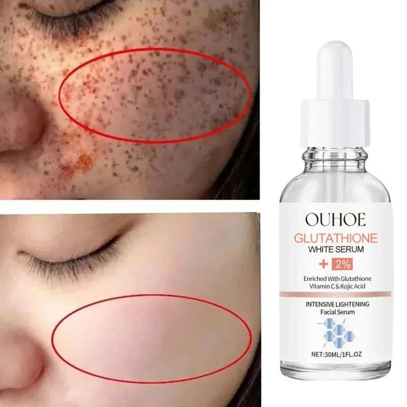 

Kojic Acid Freckle Removing Whitening Essence Fade Pigmentation Melasma Dark Spots Corrector Repair Serum Korean Skin Care