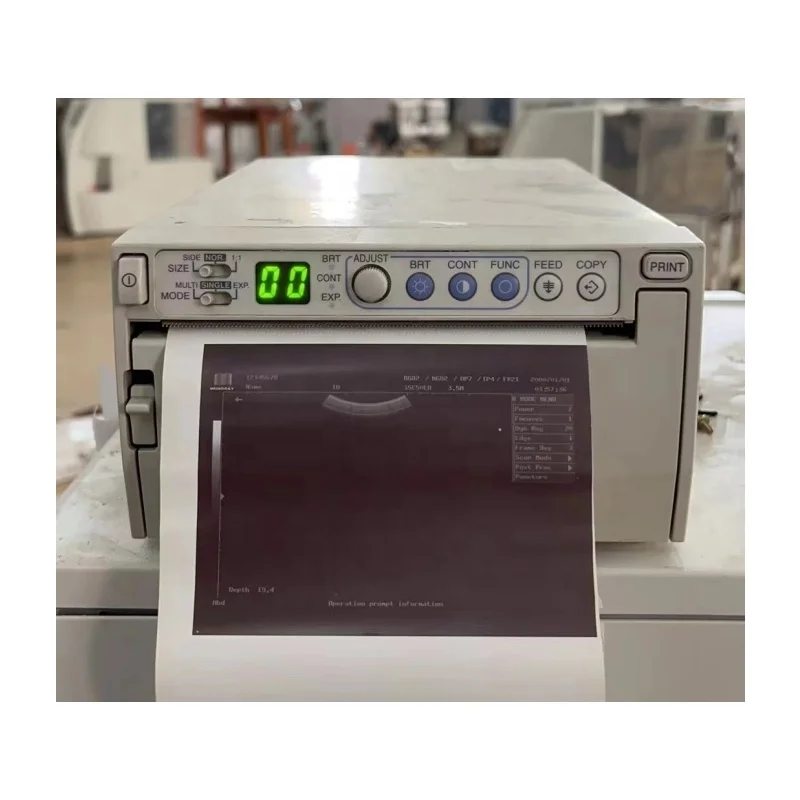 Competitive Price Medical Laboratory Ultrasound Portable Digital Printer  P93 For P93