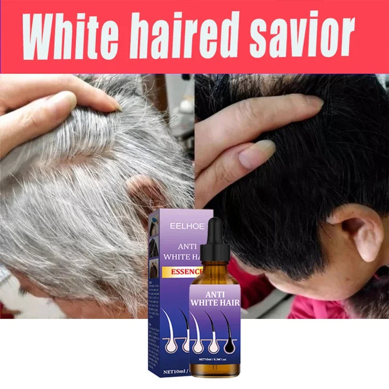 Gray White Hair Treatment Serum Liquid White To Black Natural Color Repair turns white into black, and prevents gray Men Women