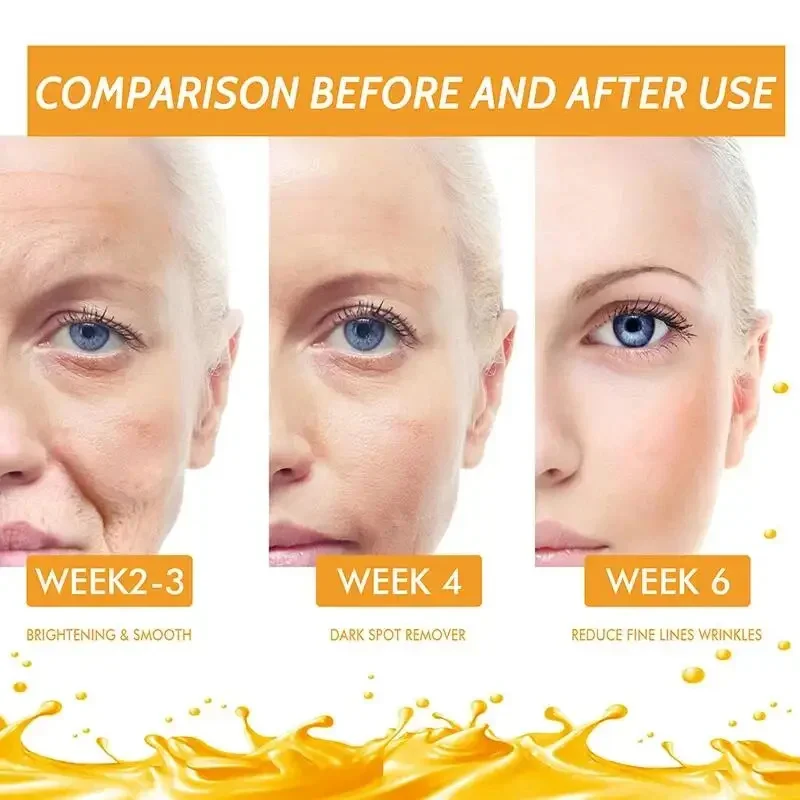 Vitamin C Whitening Serum Face Remove Dark Spots Freckle Melasma Fade Skin Melanin Retinol Anti Aging Essence Brighten Skin Care