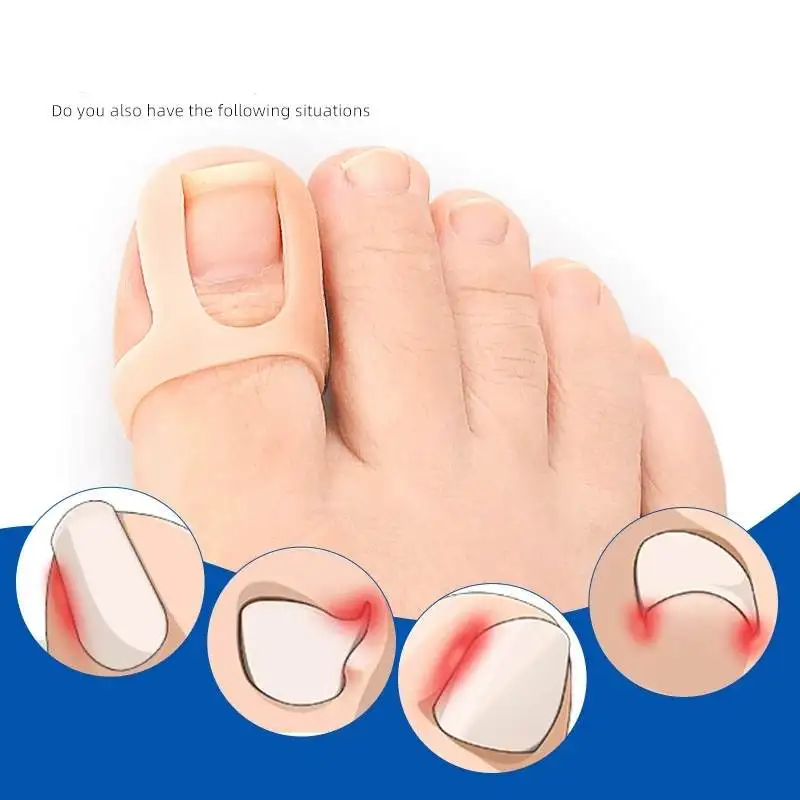 1/5/10Pairs Silicone Ingrown Toenail Correction Invisible Ingrown Toe Nail Elastic Straightening Clip Brace Protector Foot Tool