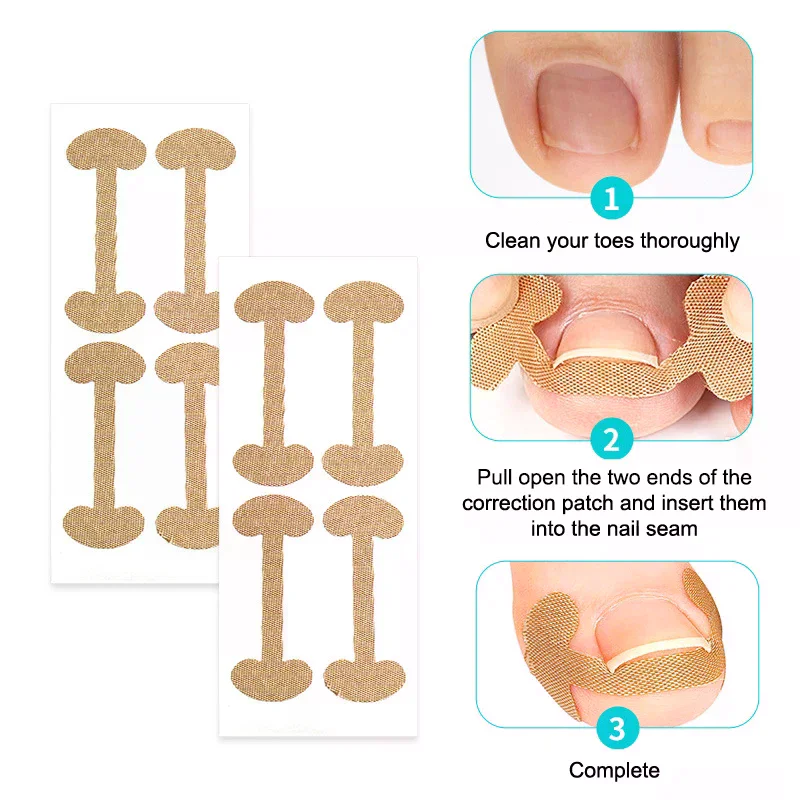 Ensemble d'autocollants professionnels pour correcteur d'ongles incarnés, soins des ongles des orteils, outils de pédicure, soins de santé, protection du traitement Paronychia