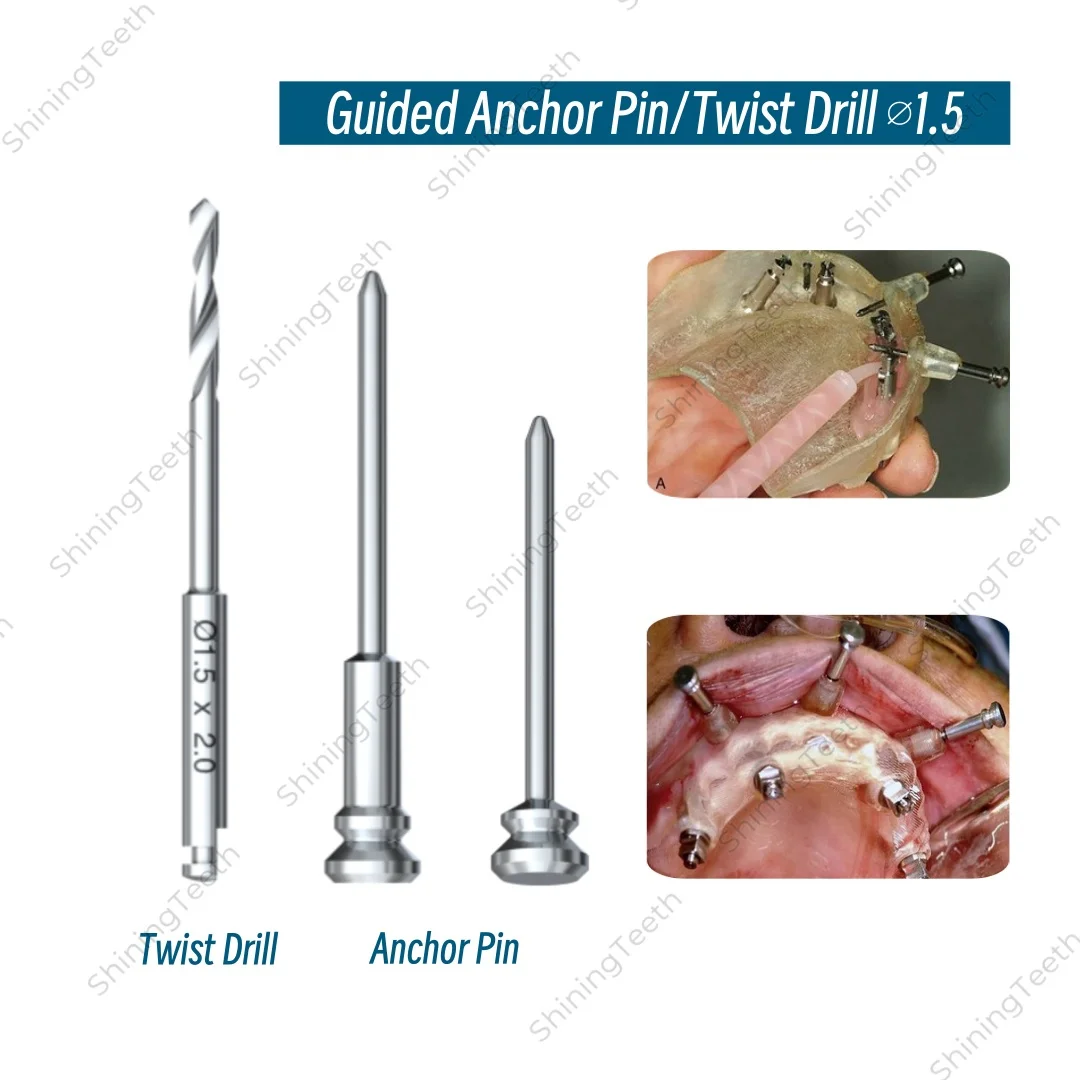 

Dental Guided Anchor Pin Kit Implant Fixation Pins with Guided Twist Drill Template Fixation for Digital Implant Guide Surgery