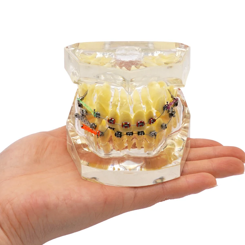 Dental Orthodontics Teeth Model with Brackets Buccal Tubes Chain Dentist Teaching Training Malocclusion Orthodontic Teeth Model