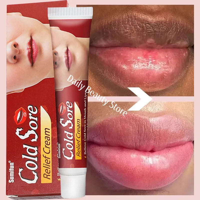 remover-balsamo-labial-escuro-clareamento-rapido-esfoliante-labial-rosa-linha-labial-hidratante-de-pele-morta-produtos-de-cuidados-coreanos-beleza-e-saude