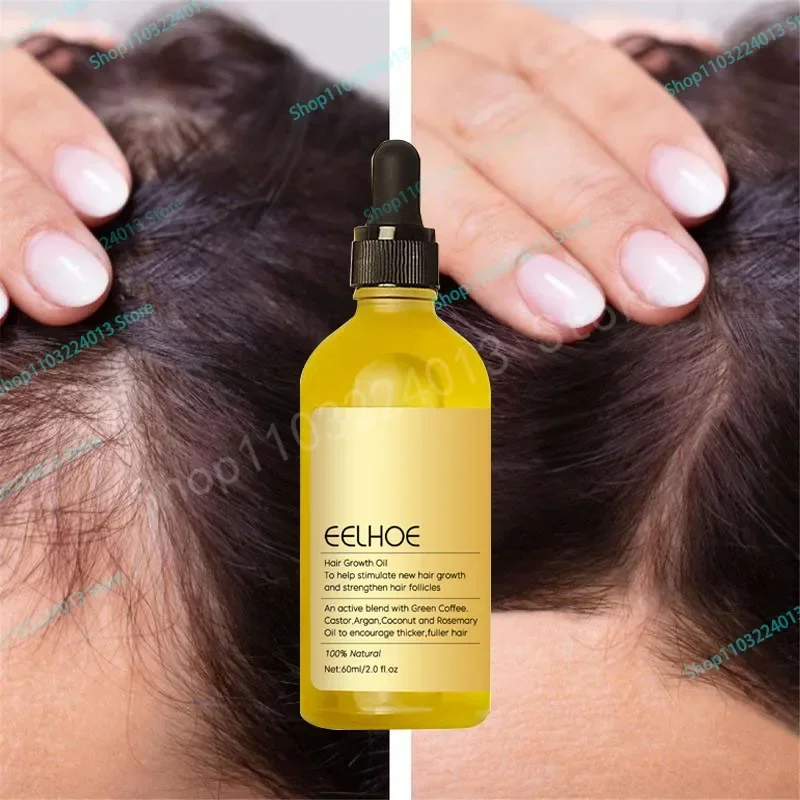 

Sdottor Hair growth oil,effective baldness repair, hereditary hair loss, postpartum hair loss