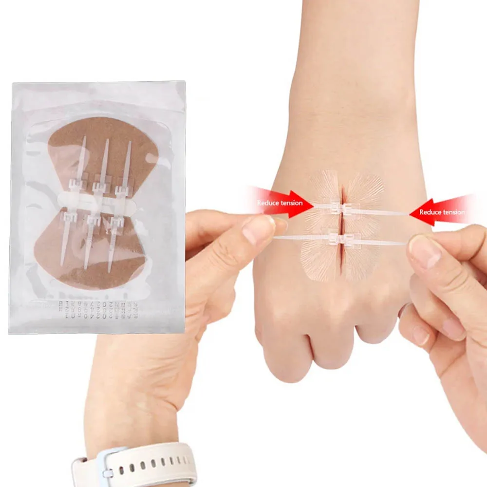 Zipper Band-aid Painless Wound Closure Device Suture-free Wound Dressing Patches Zip Suture Tension Reducer Bandage