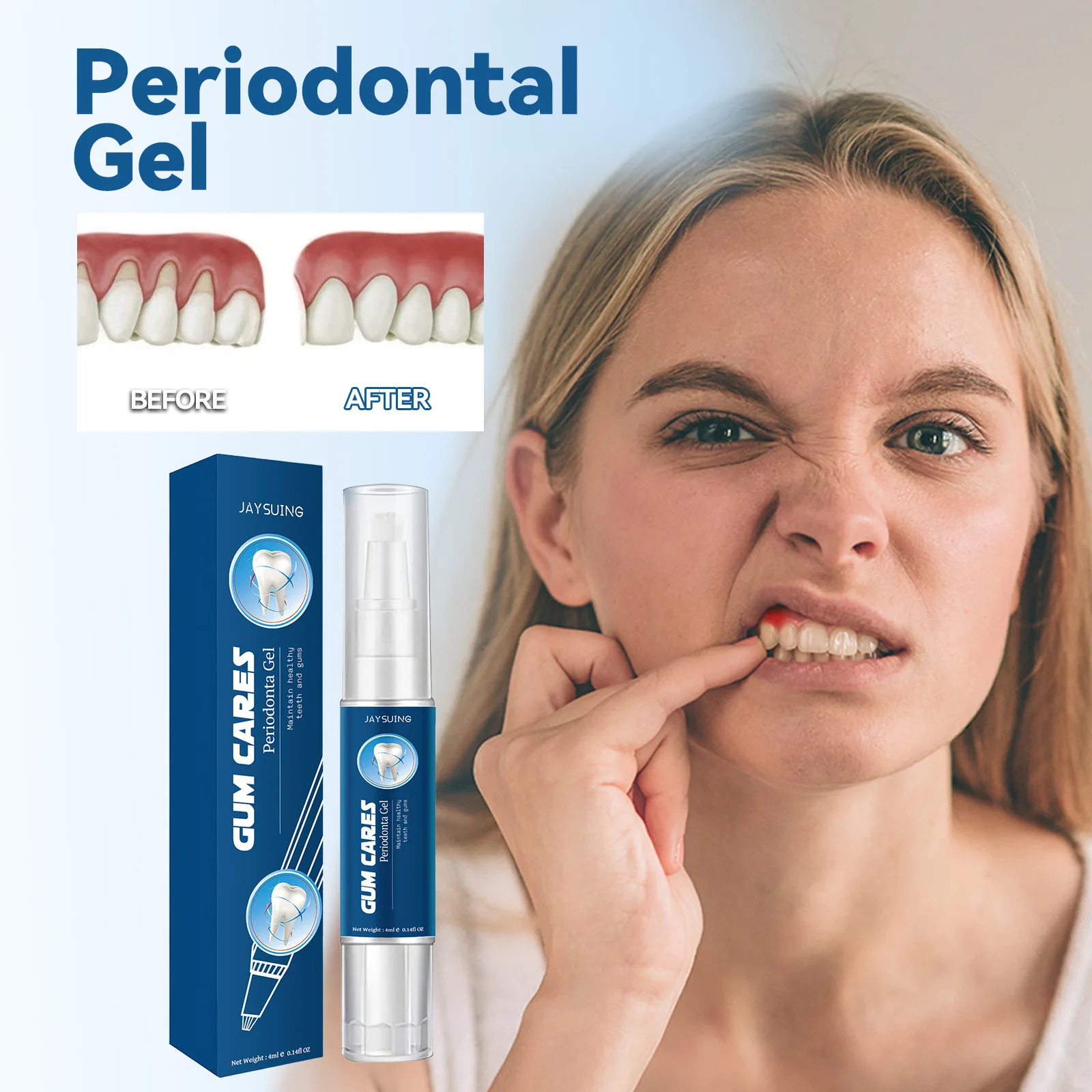 Gel antiséptico calmante para tratamiento de encías inflamadas, tejido de la boca transitorio, de la boca ulceria, abrasiones del palillo de la lengua, Blanqueador Dental