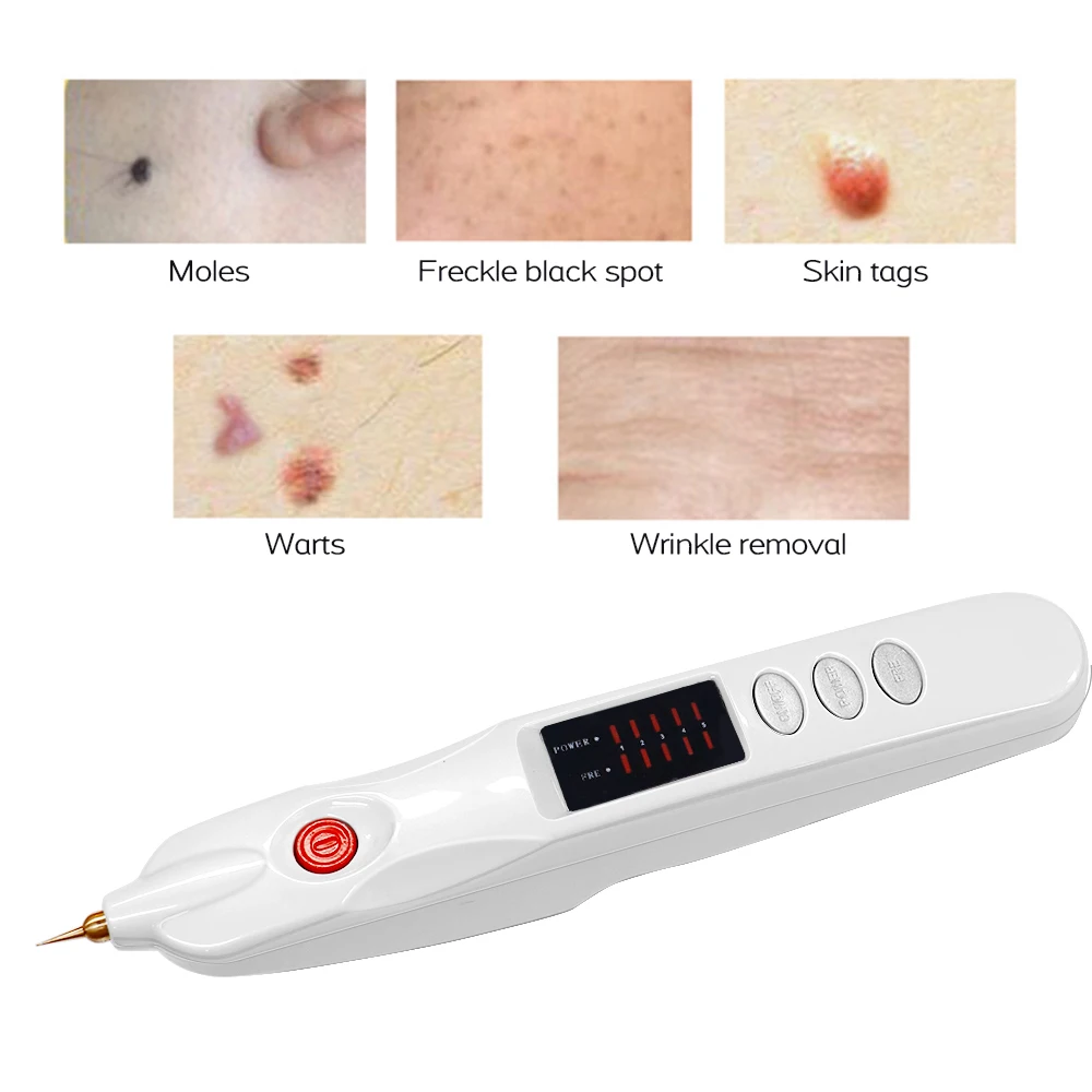 Professioneller Plasma-Pen zur Entfernung von Sommersprossen, Falten, Muttermalen, Tattoos, Mitessern, dunklen Flecken und Pigmenten, Hautpflegegerät, ionischer Schönheitsstift – Detail 8