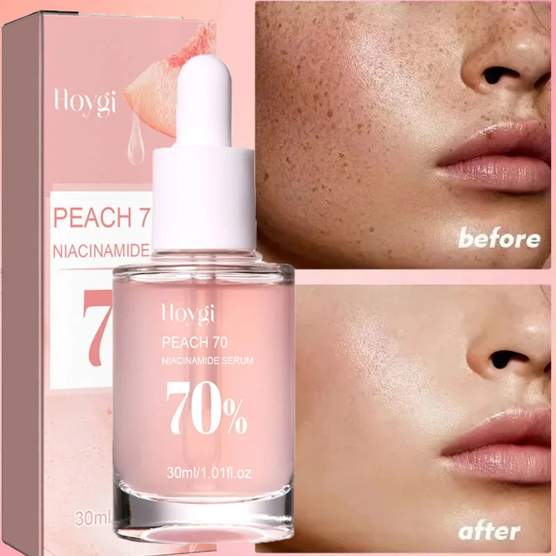 

Peach 70% Niacinamide Dark Spots Remover Face Serum Whitening Freckle Essence Moisturizing Brighten Nourish Firming Skin Care