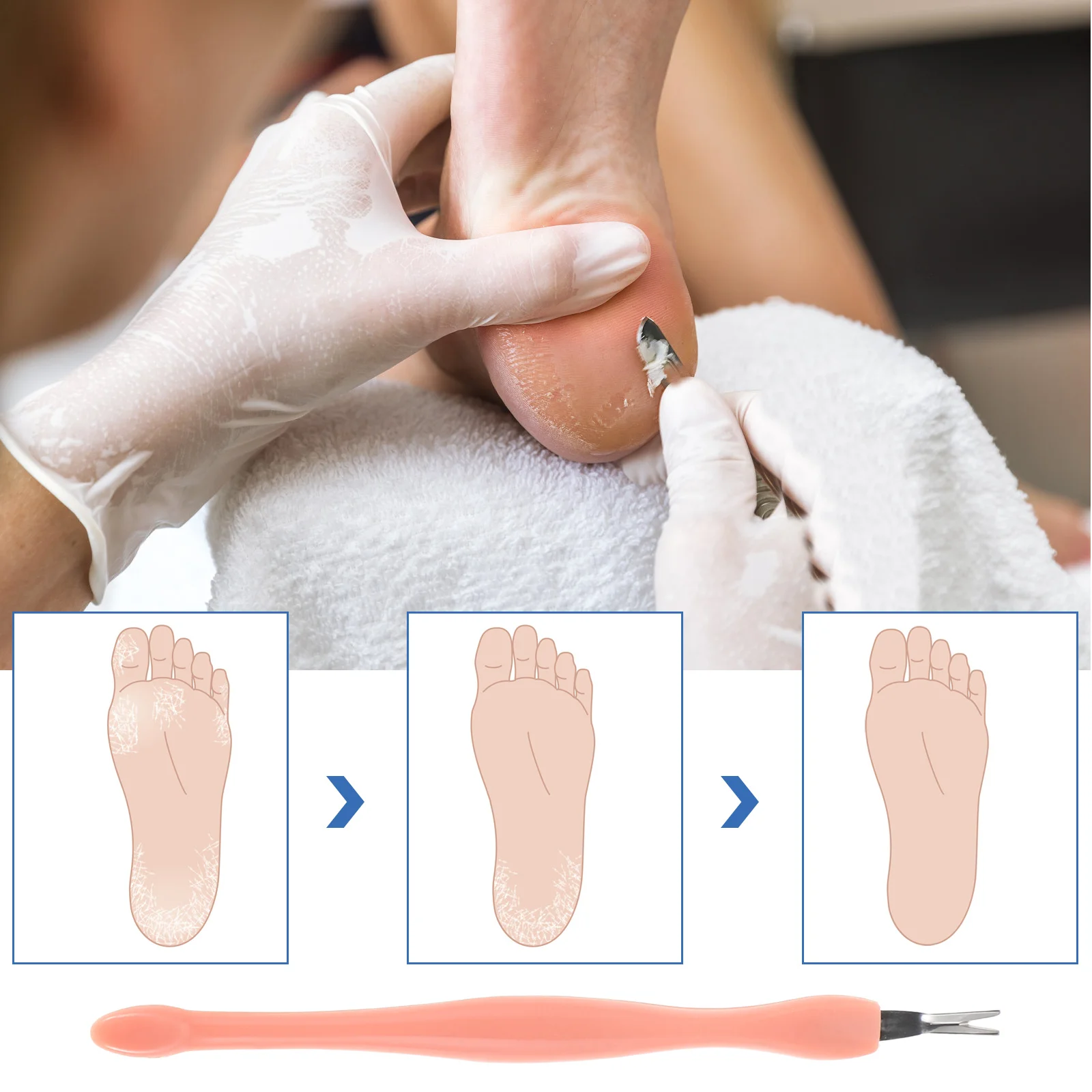 

5pcs Cuticle Trimmer Set Rough Skin Scraper Stainless Steel Nail Pusher Tool Manicure Tools For Nails Cuticle Remover Nail Salon