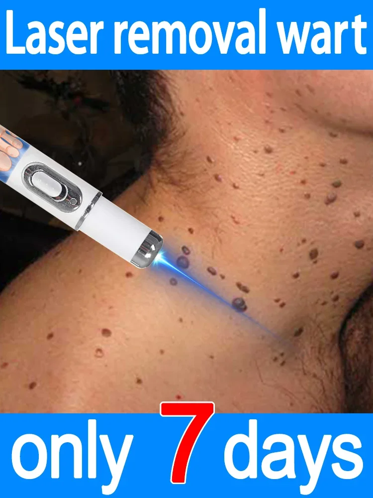 

2025 НОВЫЙ инструмент для ухода за бородами с синей ручкой, удаляет все бородавки и осветляет кожу. Инструмент для ухода за бородавками.