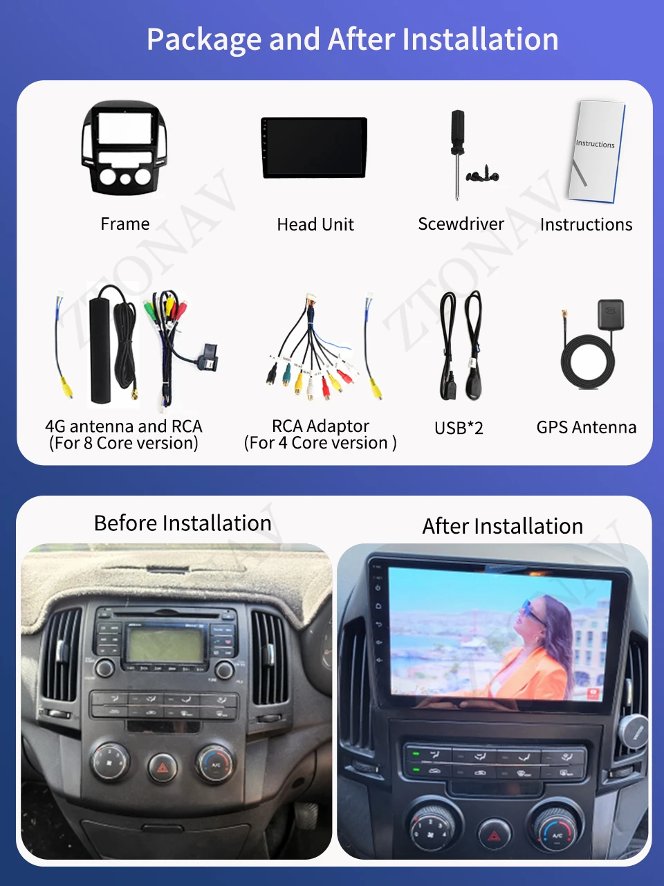 Android Radio For Hyundai I30 2006 2007 2008 2009 2010 2011 Car DVD Player Auto Headunit Carplay Android Auto Support 360 Camera